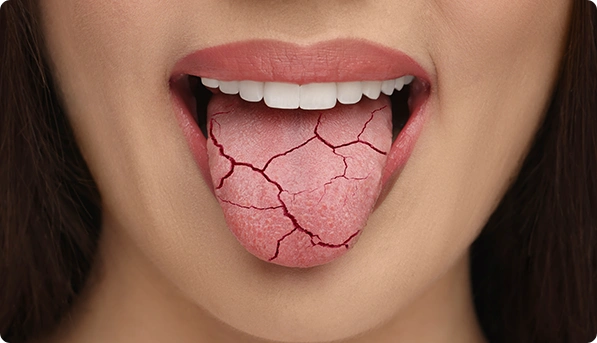 Understanding the Symptoms and Management of Drug Allergies